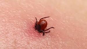 tick treatment Massachusetts